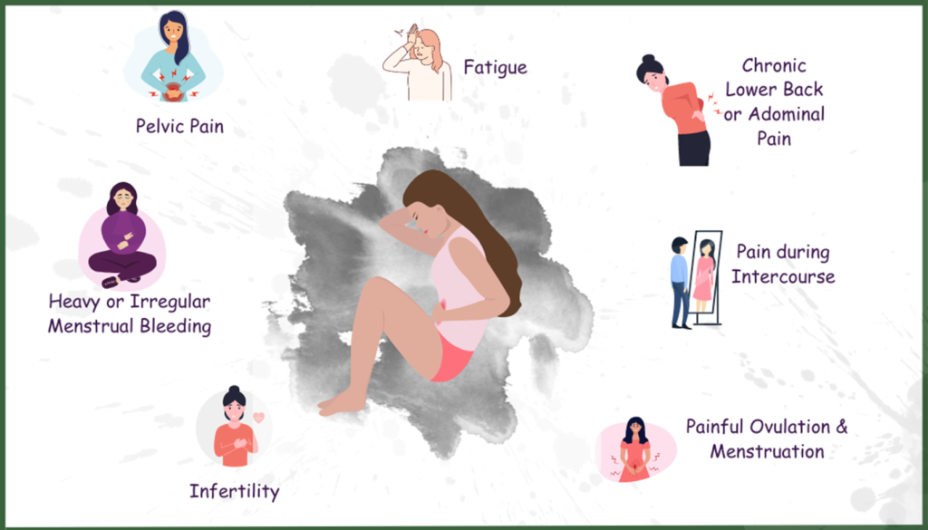 Image showing the various symptoms of Endometriosis