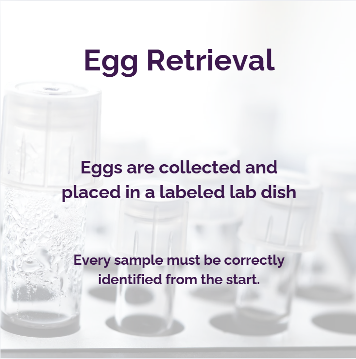 Slide: Egg Retrieval
