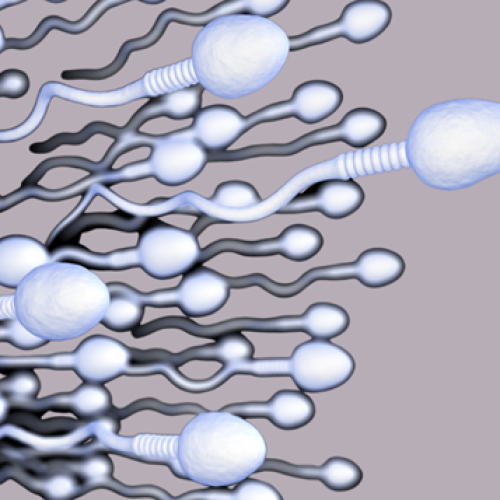 Image of sperm swimming